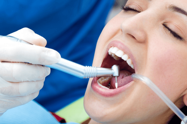 Teeth Cleaning